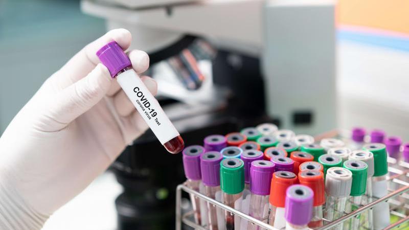 Covid, solo 12 nuovi casi ma ancora tre decessi: un medico di 63 anni tra le vittime