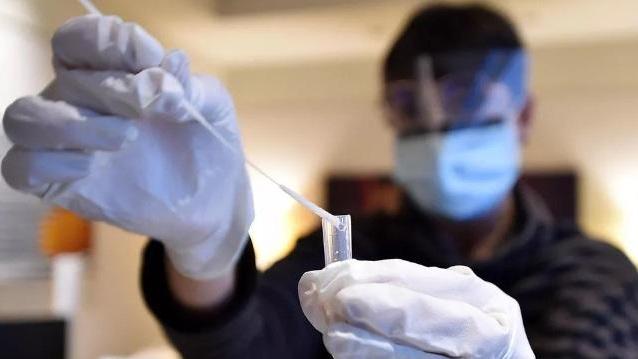 Coronavirus: a Modena 257 nuovi casi e sei decessi; sono 78 i morti in regione e 1667 i positivi in più