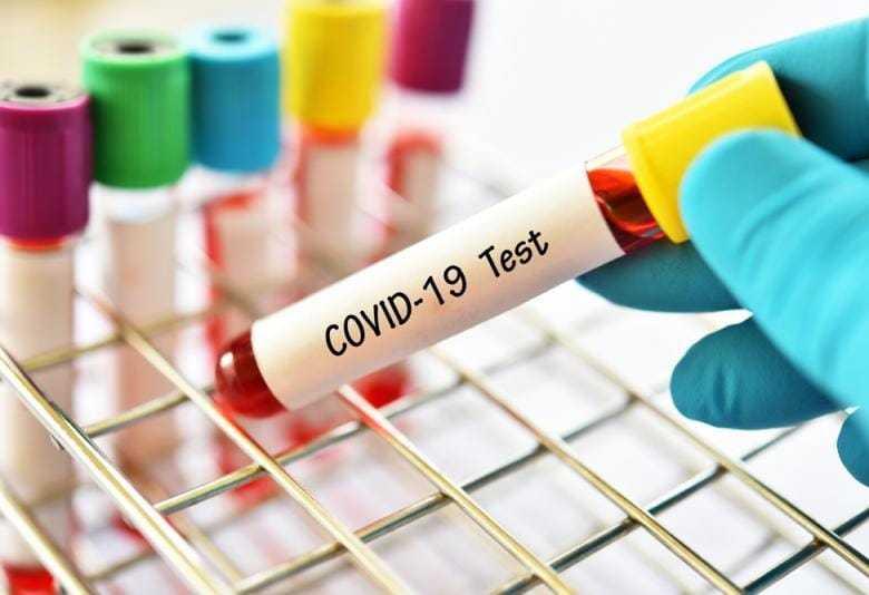 Tamponi rapidi agli studenti: si parte il 15 gennaio