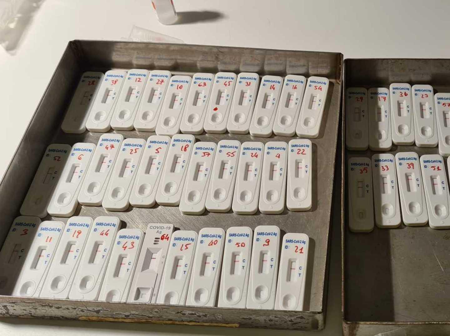 Test sierologici, solo 65 positivi 
