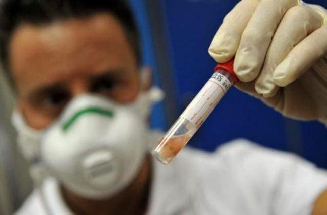 Registrati a Rolo due casi di tubercolosi polmonare 