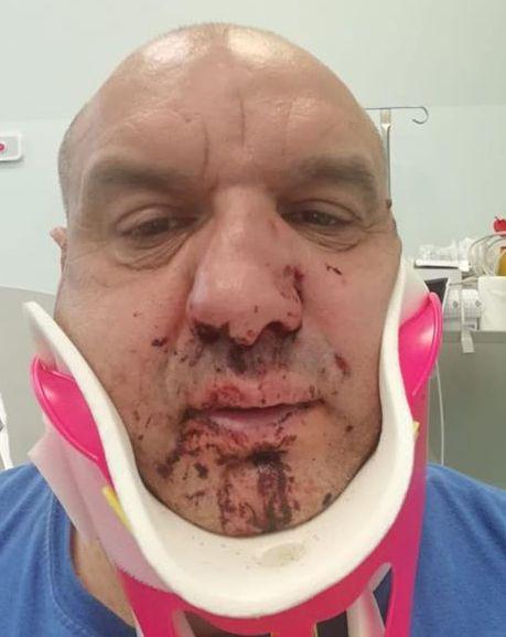 Volontario pestato, denunciati 2 turisti 