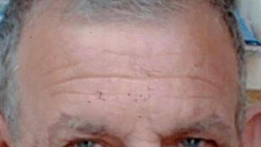 La Versilia piange altre due vittime del virus