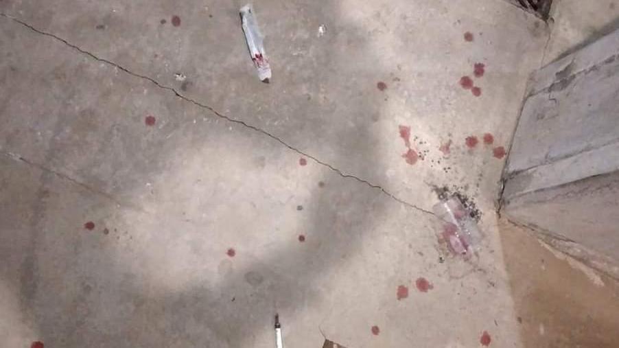 Siringhe abbandonate e tracce di sangue nello scalo ferroviario