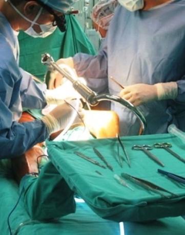 La vita di Marta stravolta da 18 anni di dolore dopo un dente devitalizzato