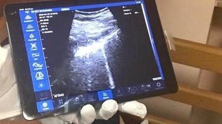 Pochi medici ma l’Asl li pensiona in anticipo. Il caso di un "mago" dell’ecografo