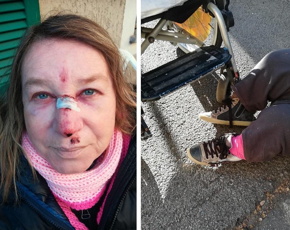 Lorella Ronconi con il volto ferito dopo la caduta e, a destra, a terra sull'asfalto