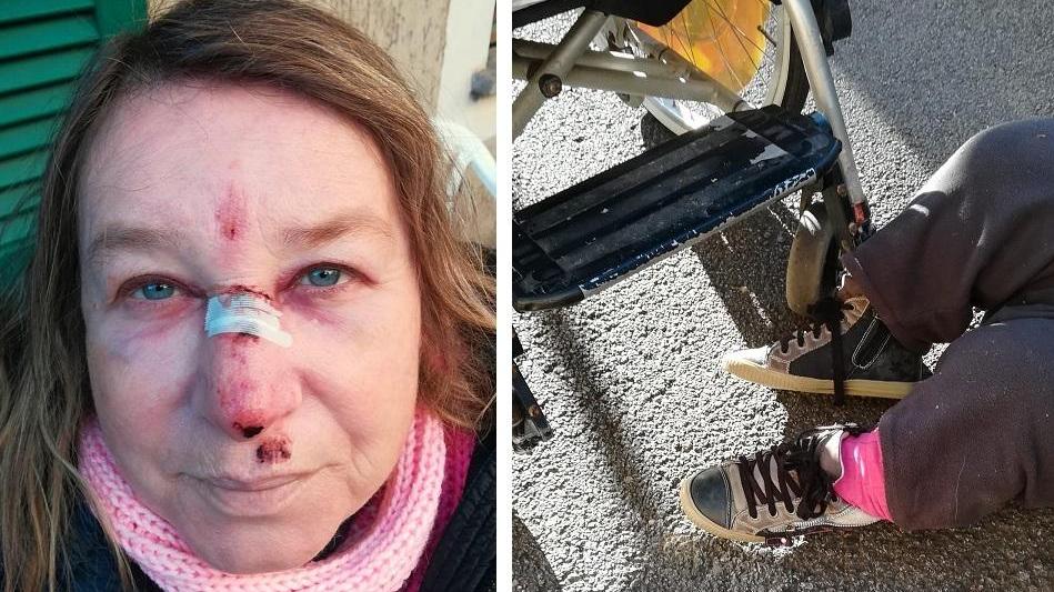 Lorella Ronconi con il volto ferito dopo la caduta e, a destra, a terra sull'asfalto