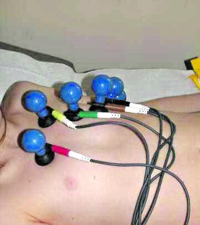 A Olbia non si fanno ecocardio ed esami holter: pazienti mandati all'ospedale di Tempio 