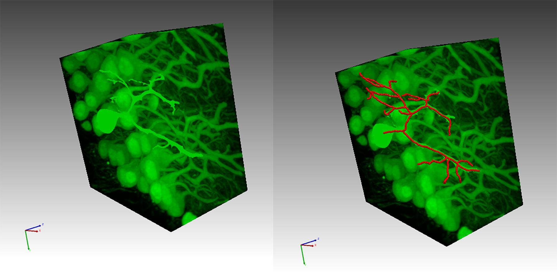Due immagini che mostrano come la tecnologia impiegata nel progetto SENSEI consenta di isolare i neuroni