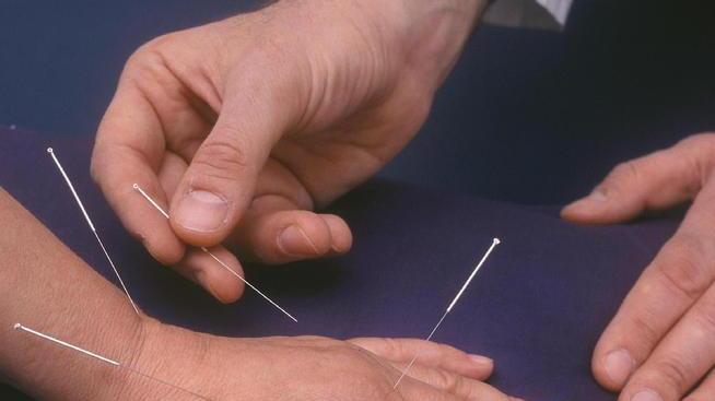 Previsti due incarichi per medici agopuntori La durata è di un anno