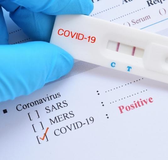 Test gratuiti in farmacia ma è una falsa partenza I kit non sono arrivati