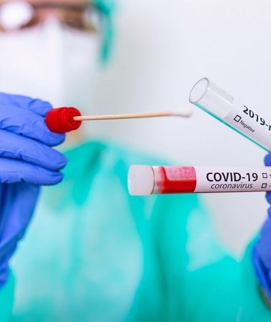 Test gratis in farmacia Forse è la volta buona 