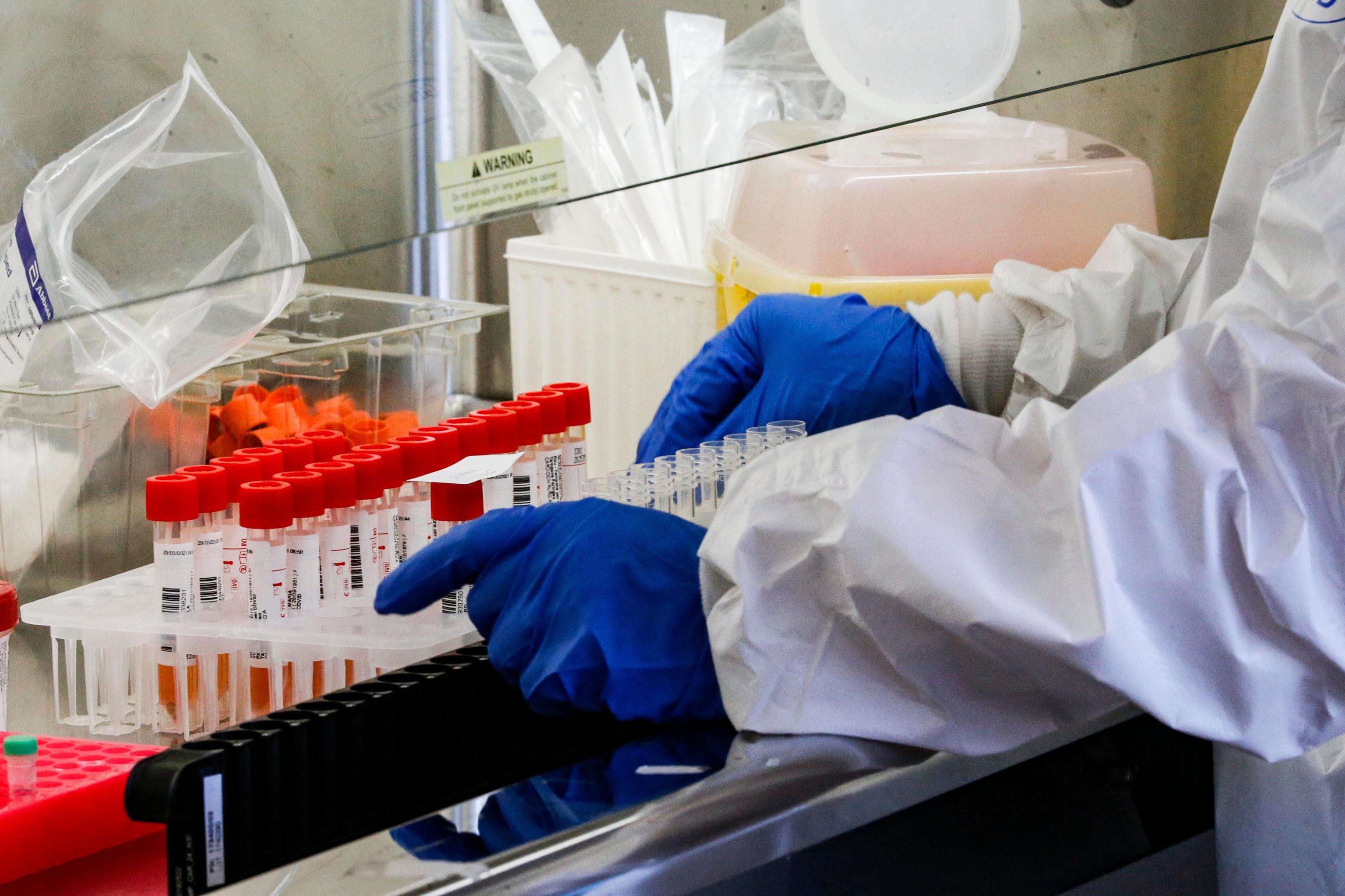 Oristano, caso di Covid nell'ufficio comunale dell'ambiente 