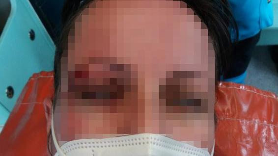 Prende a pugni una donna per strada senza alcun motivo