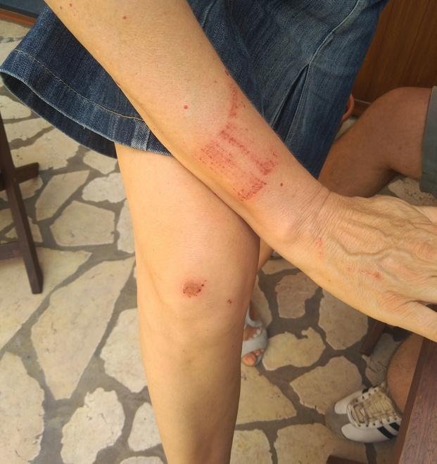 Ferrara, fotografa i fiori di casa e lo spacciatore l’aggredisce: «Tu non mi fai le foto» 