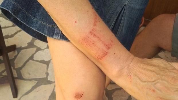 Ferrara, fotografa i fiori di casa e lo spacciatore l’aggredisce: «Tu non mi fai le foto»