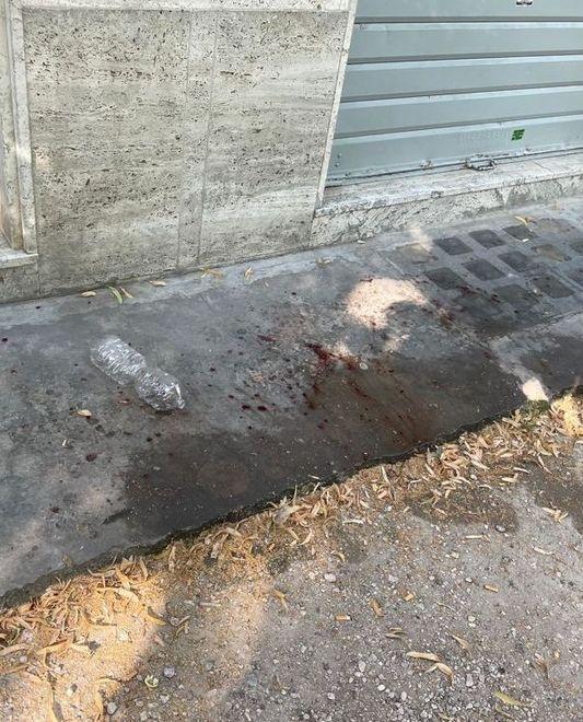 Pestato a sangue sotto casa da tre uomini incappucciati 