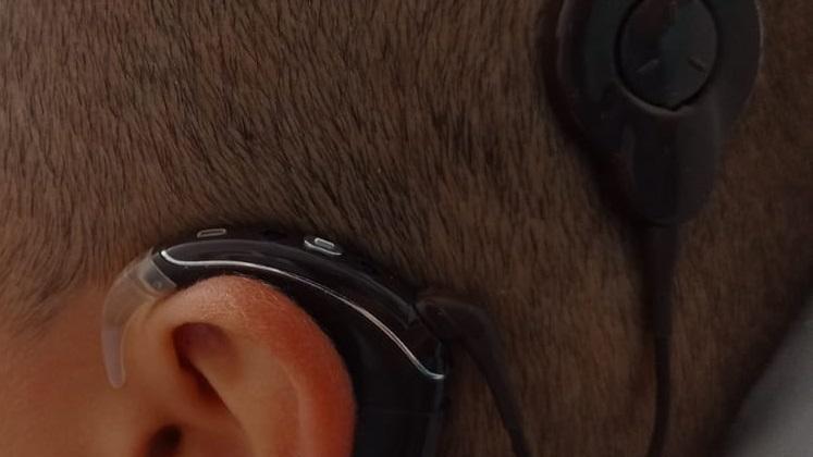 Sassari, orecchio bionico in un bambino di 7 anni non udente