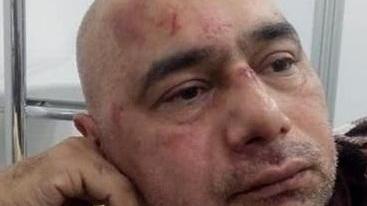 «Pestato per un’ora» Rapinatore a processo