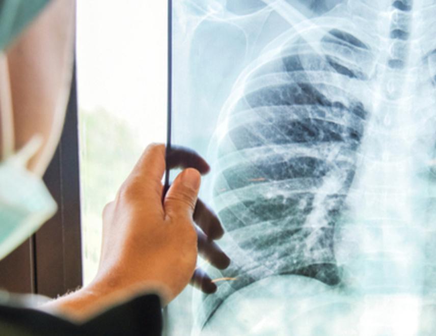 Per la radiografia c’è posto ma solo a Prato a marzo 2022 