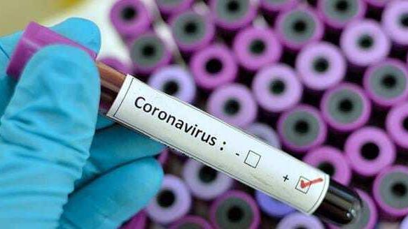 I contagi scendono sotto quota cento: sono 79 i nuovi casi