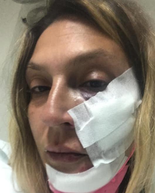 Donna picchiata a sangue per aver aiutato dei cagnolini 