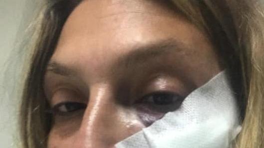 Donna picchiata a sangue per aver aiutato dei cagnolini
