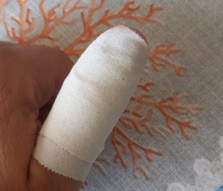 Senza biglietto aggredisce il capotreno e gli morde il dito 