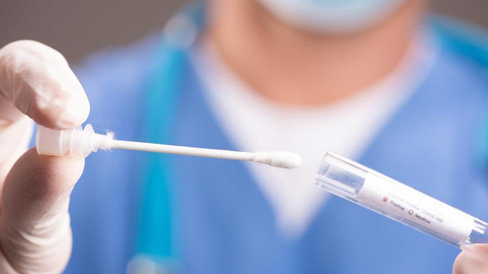 Coronavirus in Emilia Romagna. Bollettino del 7 settembre: 396 nuovi positivi e 2 deceduti. Nel Modenese 64 casi