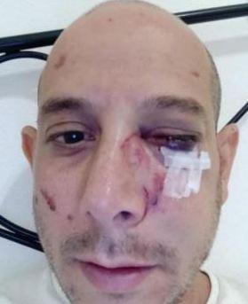 «Odio Israele, ebrei assassini» e picchia il turista israeliano 