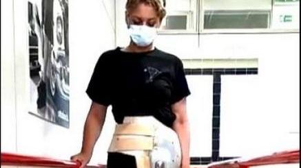 Laura Ruffato, 20 anni, con la sua vecchia protesi