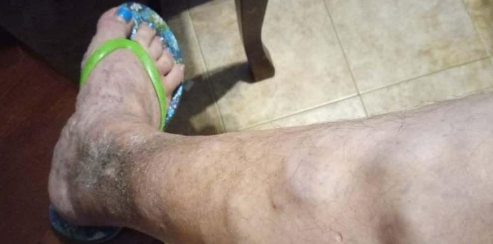 «Se non mi visitano per farmi il vaccino perderò il lavoro» 