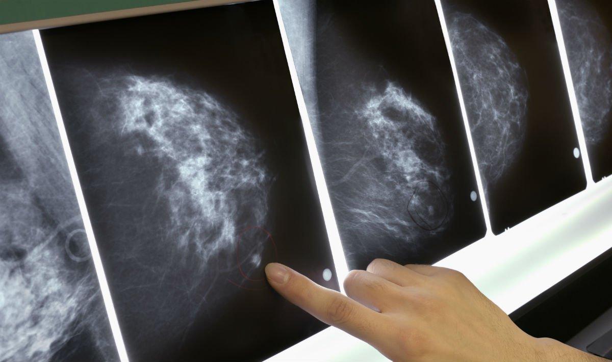 Ospedale Versilia, attese record per le ecografie ma non solo: la classifica degli esami lumaca   
