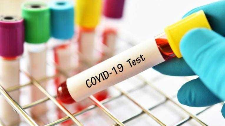 Covid, 51 nuovi contagi in provincia di Lucca Cala trend settimanale