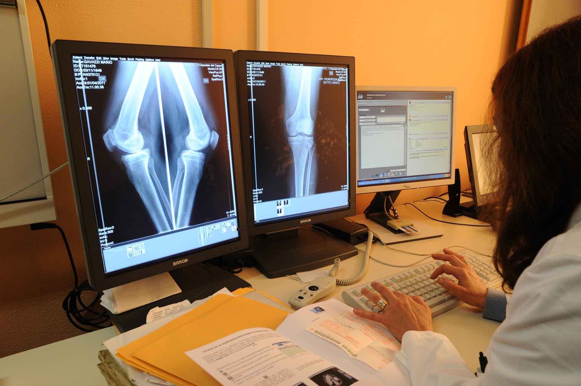 La radiografia? A primavera a Pontremoli. Anche le visite specialistiche in difficoltà in Versilia