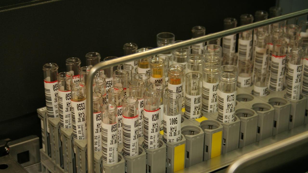 Ausl Modena senza reagenti: "razionati" gli esami delle urine
