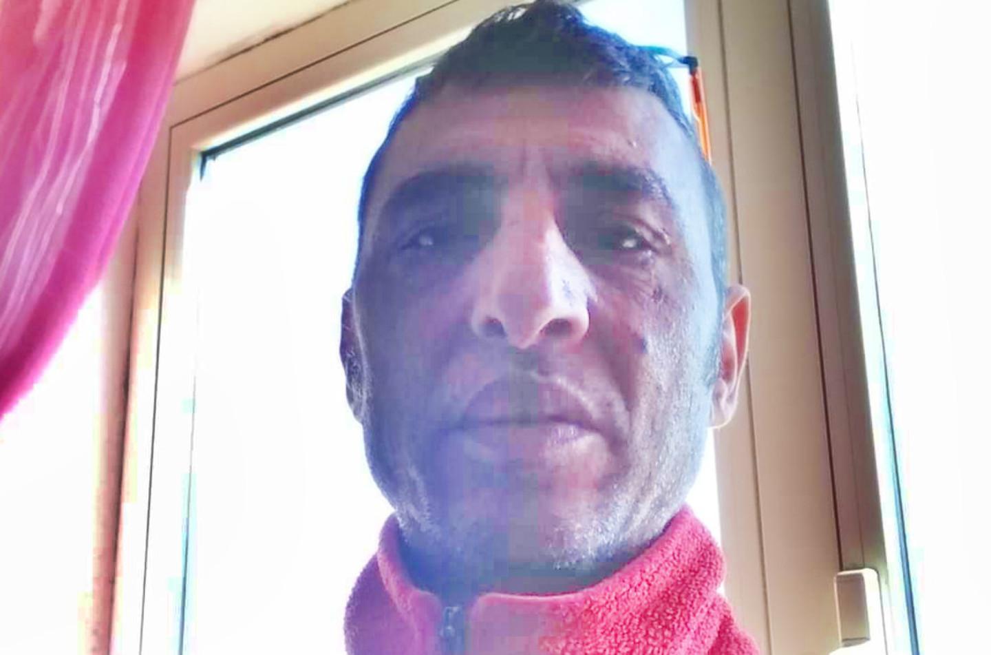 Dato alle fiamme dal rivale Tony Cozzolino gravissimo 
