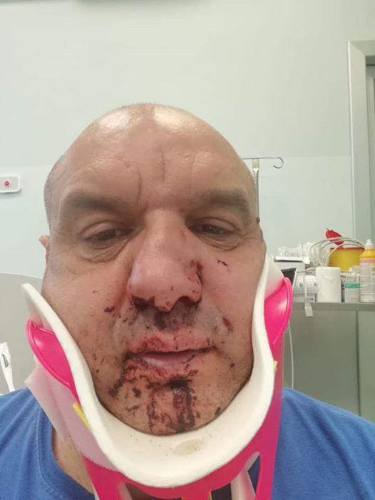 Pugno al soccorritore a Porto Cervo, a processo il turista