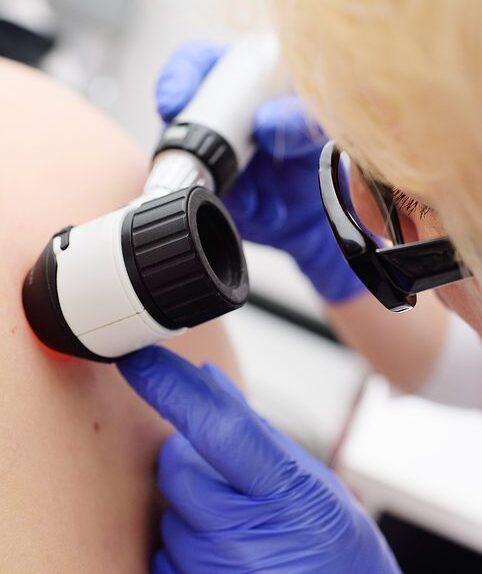 Pisa, morto a 42 anni  per un melanoma non diagnosticato: il risarcimento arriva dopo 37 anni 