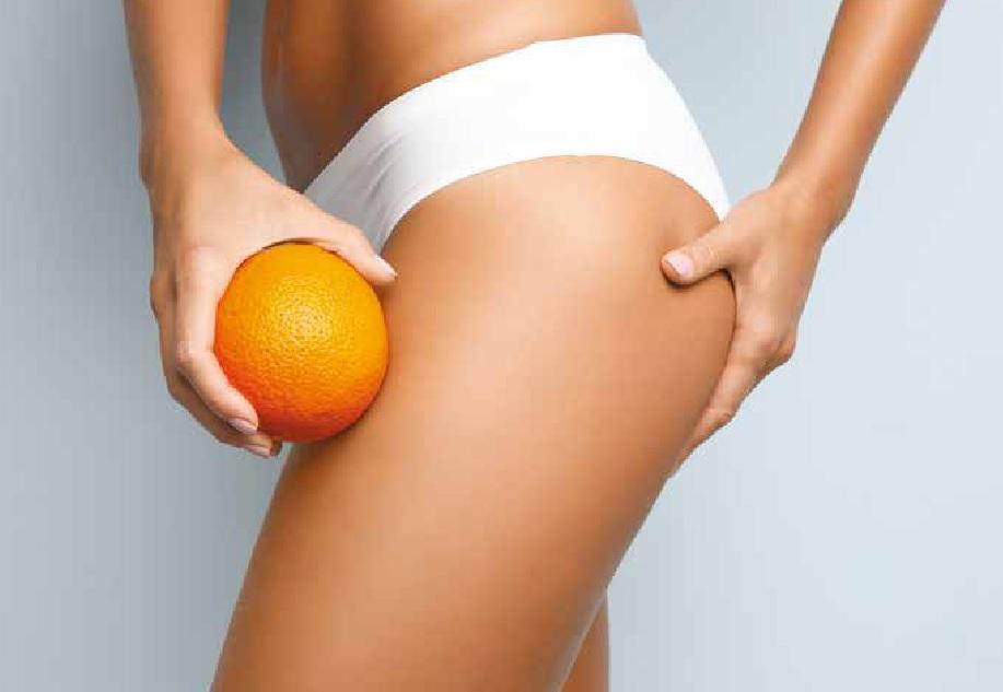 I trattamenti per eliminare la cellulite e alcuni consigli per prevenirla