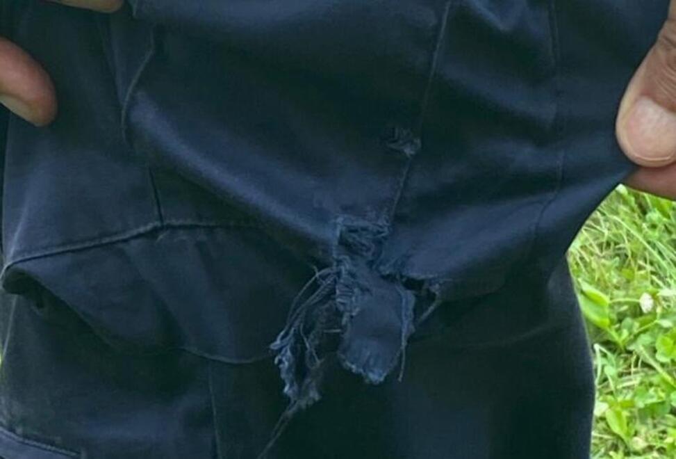 L’agente mostra il pantalone strappato dopo l’assalto del cane