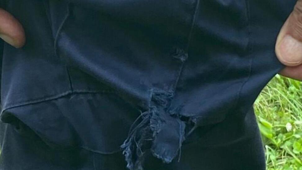 L’agente mostra il pantalone strappato dopo l’assalto del cane