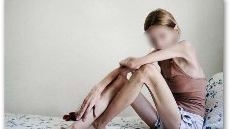 Ferrara, l'allarme dei genitori: «Qualcuno aiuti nostra figlia, l’anoressia la sta uccidendo»