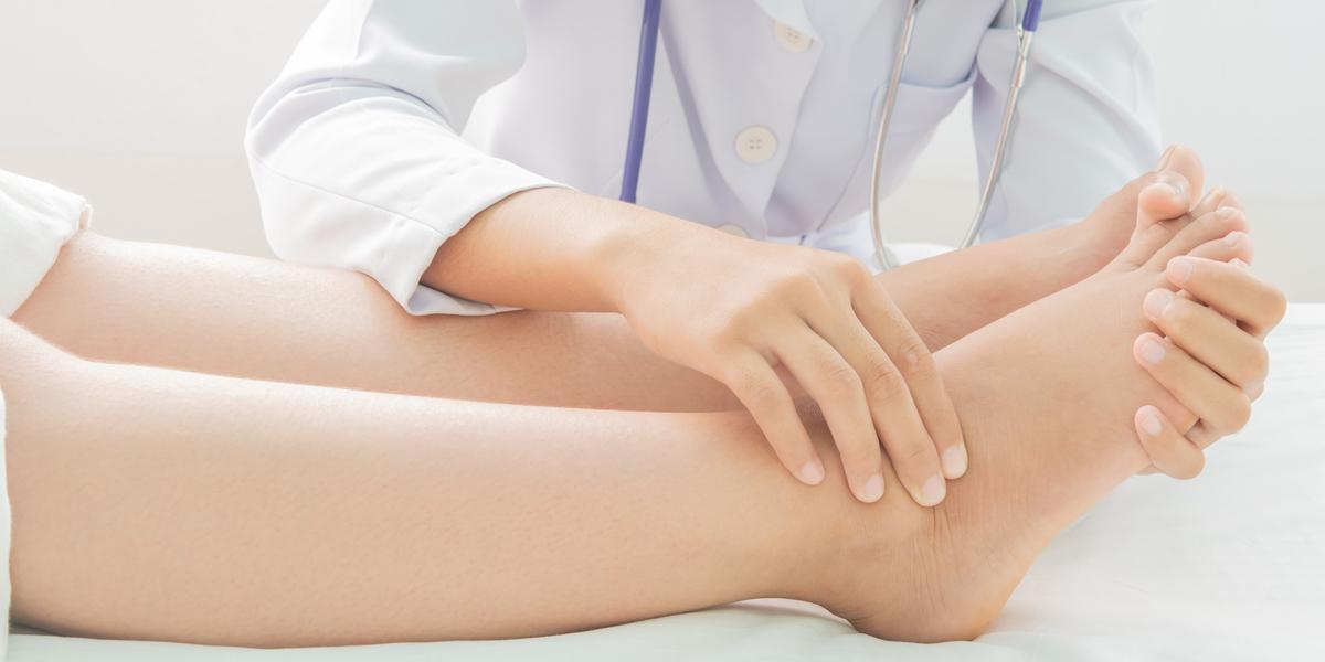 Gambe gonfie, come prendercene cura: i consigli del dottor Ciatti