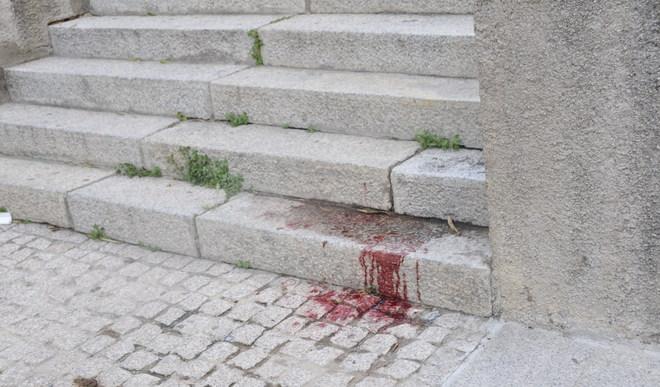 Ragazza di 23 anni colpisce la madre con tredici coltellate 