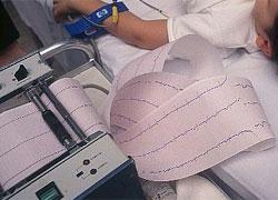 Elettrocardiogramma gratis per tanti abitanti di Sassetta 