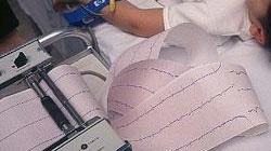 Elettrocardiogramma gratis per tanti abitanti di Sassetta