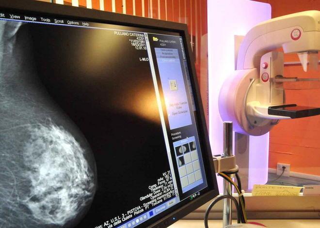 Oltre 9 mesi per un’ecografia al seno 