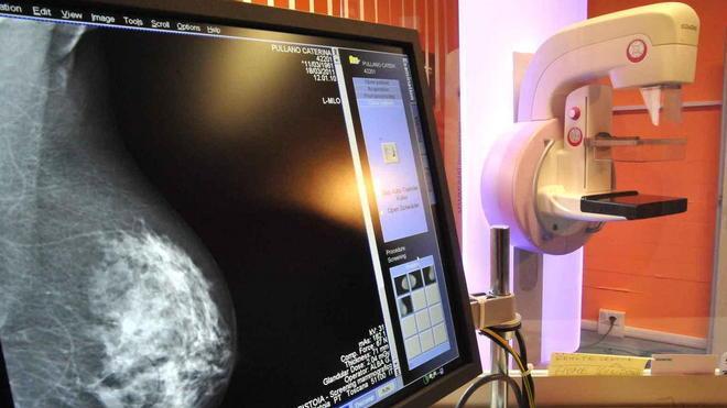 Due anni per una mammografia L’Asl: «Solo un fraintendimento»